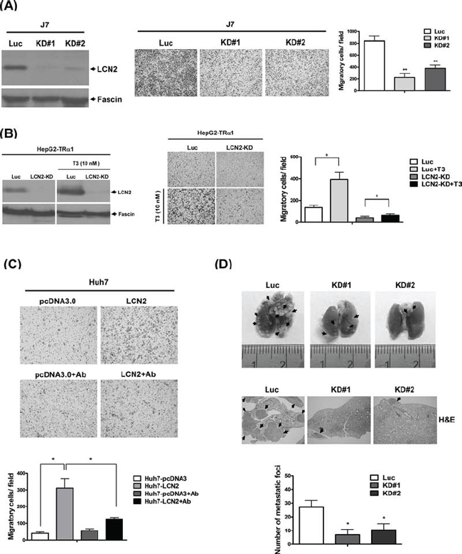 LCN2 depletion suppresses cell mobility in vitro and in vivo.