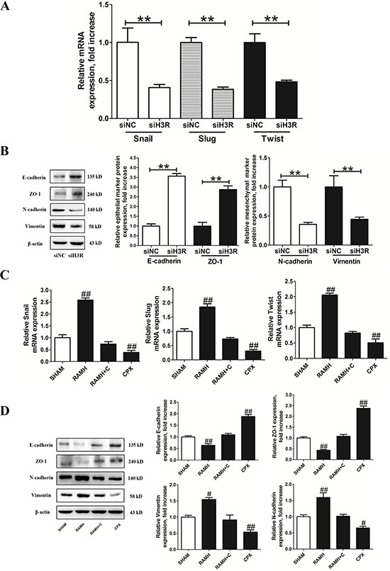 Inhibition of the H3R by the siRNA or CPX suppressed EMT progression in U87MG cells.