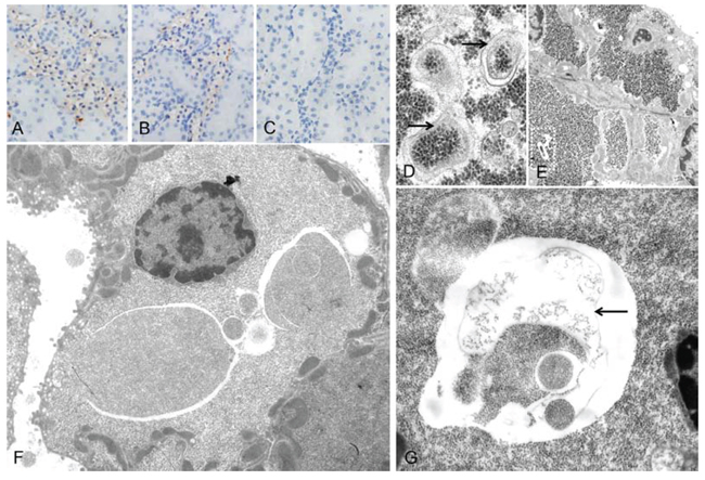 Autophagic activity in rat clear cell tubulus lesions.
