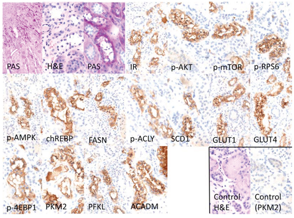 Representative immunohistochemical findings in serial cryostat sections series of human glycogenotic tubules.