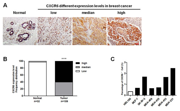 CXCR6 is higher expressed in BC tissues and cell lines than in the normal controls.