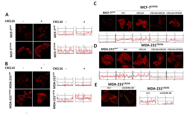 CXCL16/CXCR6 chemokine axis promotes stress fibres assembly through ERK1/2 pathway.