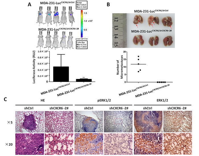 Targeting CXCR6 expression reduces lung metastasis of BC