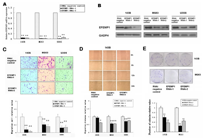 Downregulation of EFEMP1 in osteosarcoma cell lines suppressed migration, invasion and colony formation