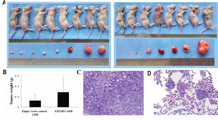 Tumorigenicity of osteosarcoma cells that overexpress EFEMP1.