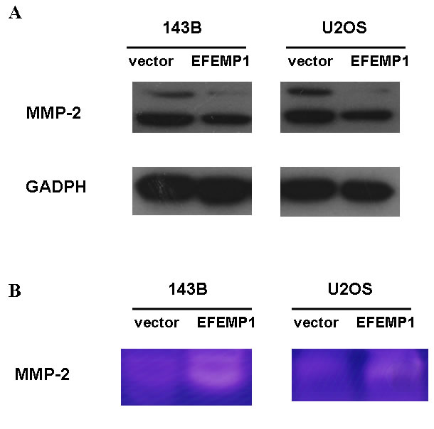 EFEMP1-mediated tumor cell migration and invasion was linked to MMP-2.