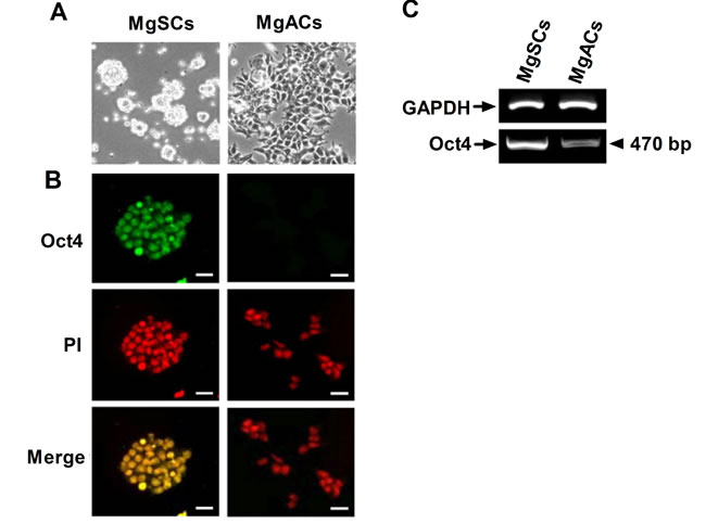 Expression of Oct4 in meningioma sphere cells (MgSCs) and meningioma adherent cells (MgACs).