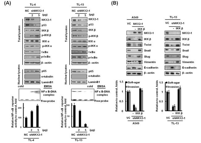 NKX2-1-mediated IKK&#x3b2;/NF-&#x3ba;B activation promotes soft-agar growth and invasiveness in lung adenocarcinoma cells via induction of EMT.