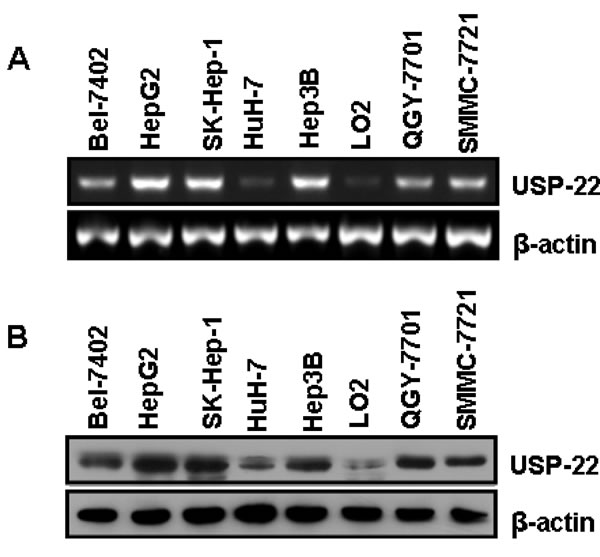 USP22 expression in HCC tissues and cell lines.