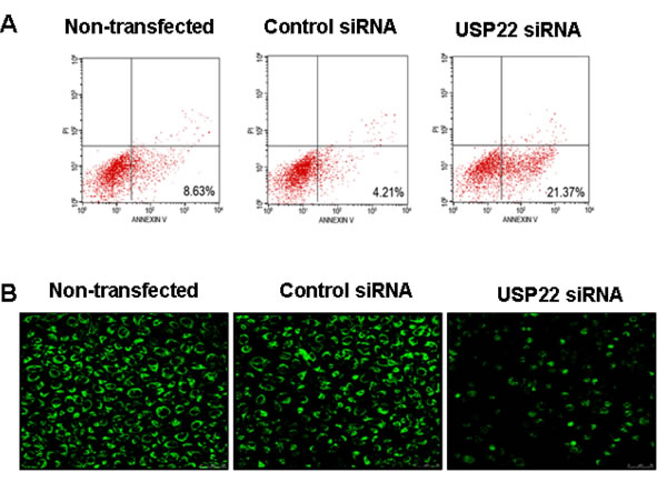 USP22 gene silencing leads to HCC cell apoptosis.