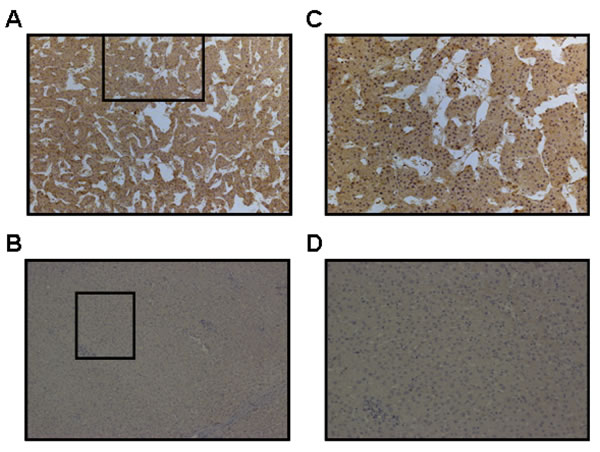 Immunohistochemical staining for USP22 in HCC and normal adjacent hepatic tissues.