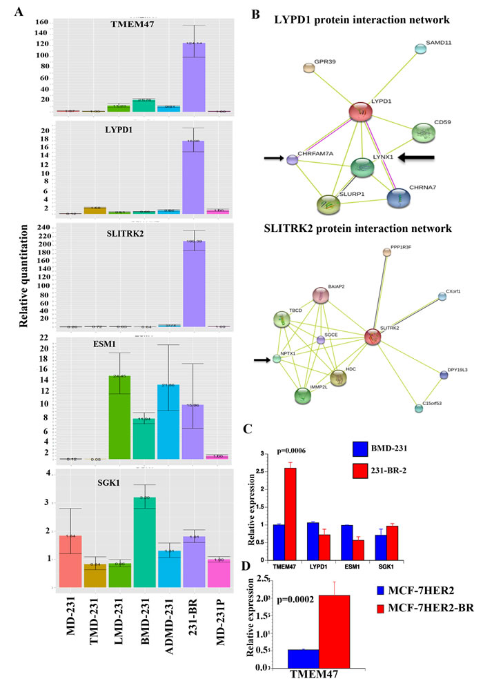 Validation of genes differentially expressed in brain metastatic cells.