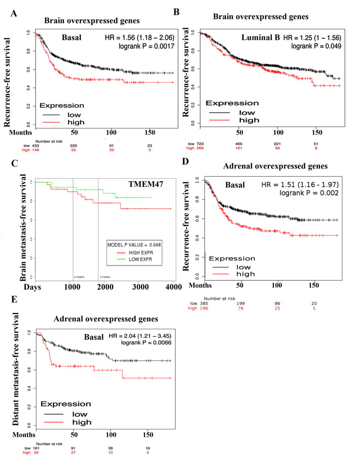 Prognostic value of genes overexpressed in 231-BR and ADMD-231 cells.