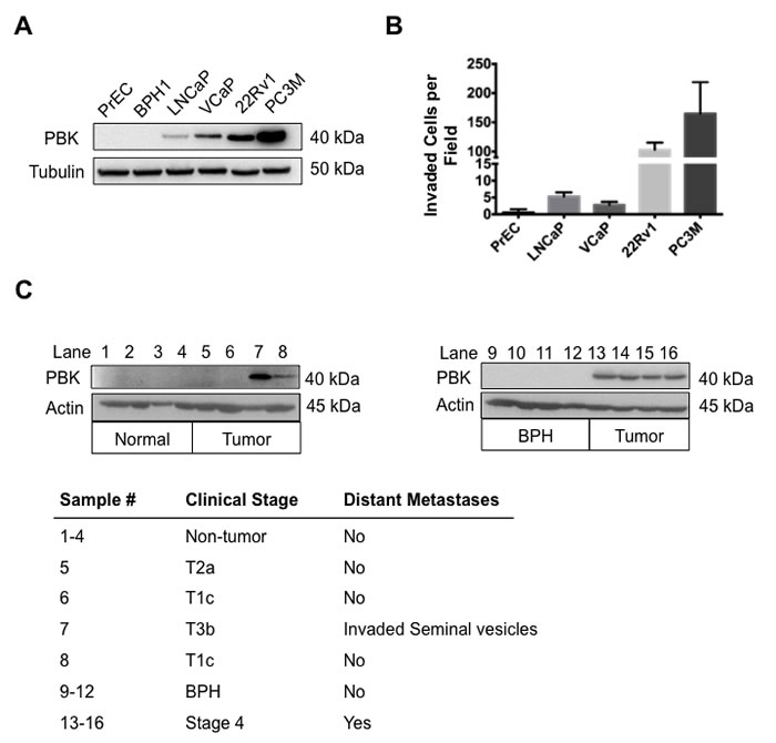 Levels of PBK in prostate cancer cell lines correlate with invasion through Matrigel.