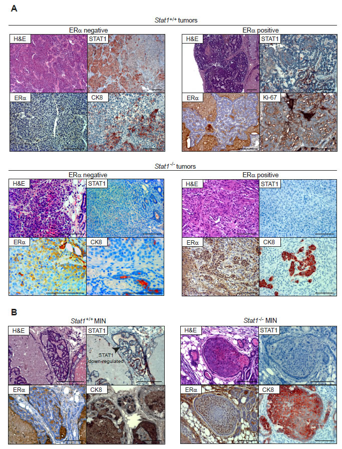(A) Both, Stat1+/+ and Stat1-/- mammary tumors are heterogenous.
