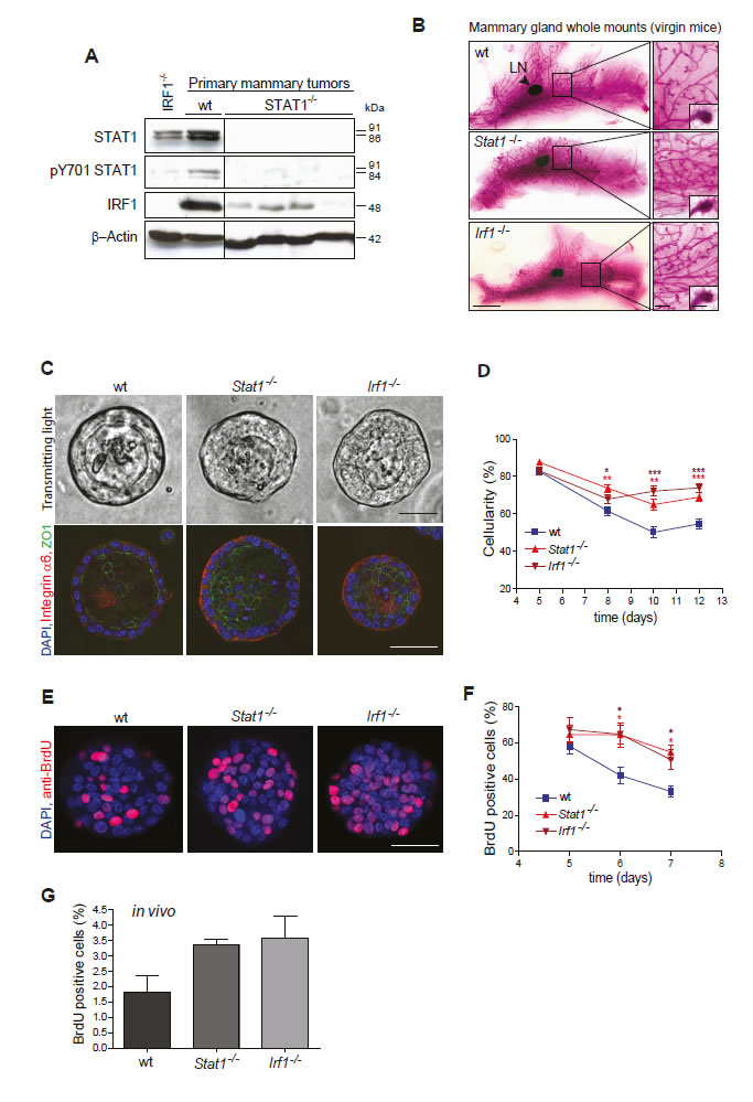 (A, B) Loss of STAT1 might cause mammary tumor formation by down-regulating IRF1.
