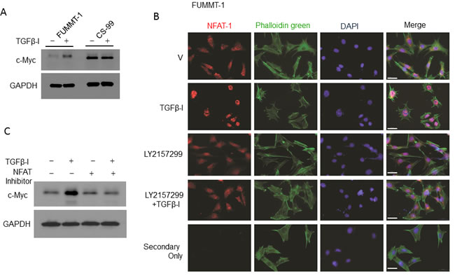 TGF&#x3b2;-I mediated c-Myc expression is regulated through NFAT-1.