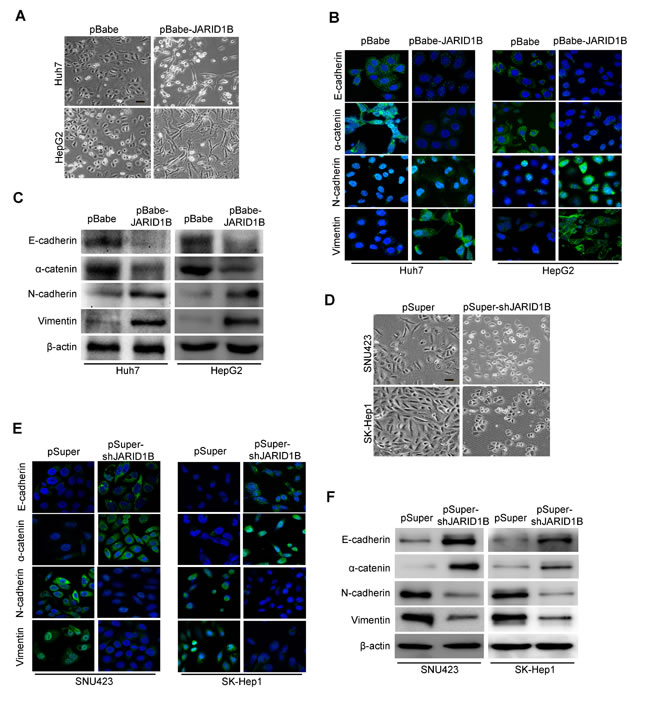 JARID1B regulates the transition between epithelial and mesenchymal phenotypes in HCC cells.