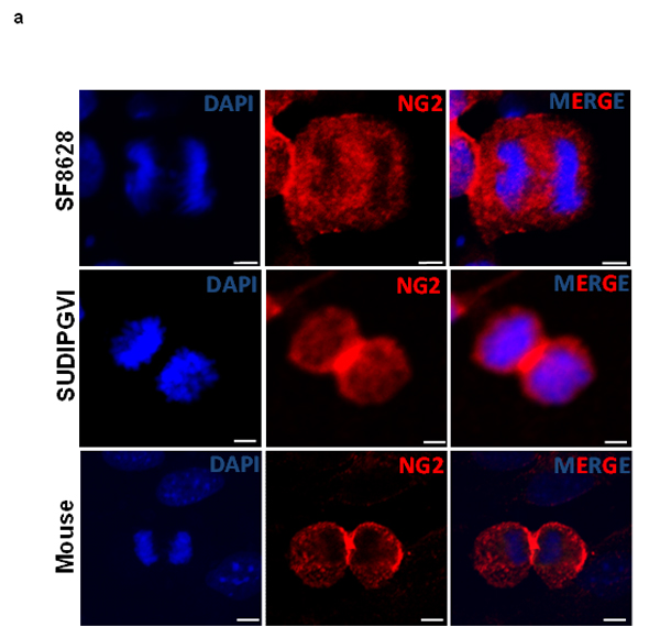 Mouse and human DIPG neurospheres exhibit symmetric NG2 expression