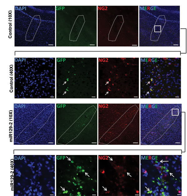 miR129-2 targets and downregulates NG2