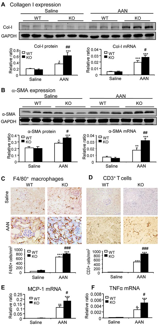 Disruption of Smad7 enhances AA-induced renal fibrosis and inflammation at day 42 after induction of AAN.