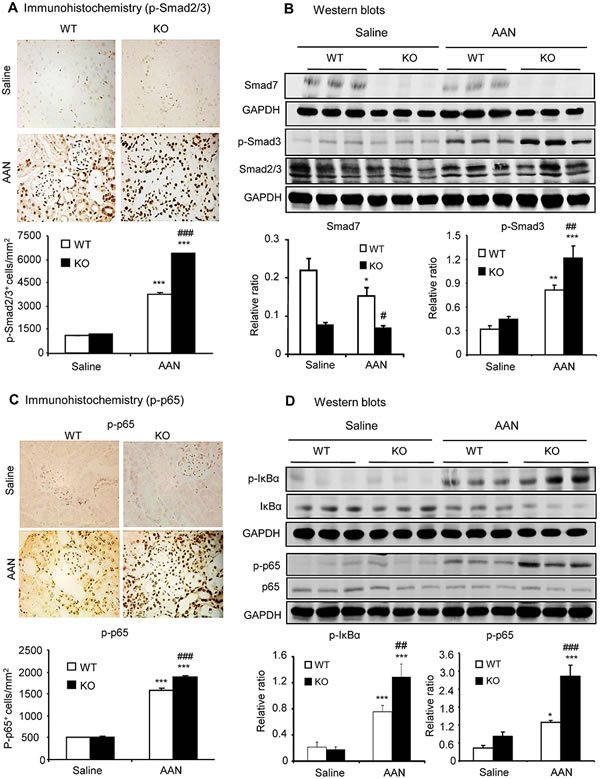 Disruption of Smad7 sustains TGF-&#x3b2;/Smad and NF-&#x3ba;B signaling in the kidney with chronic AAN at day 42 after induction of AAN.