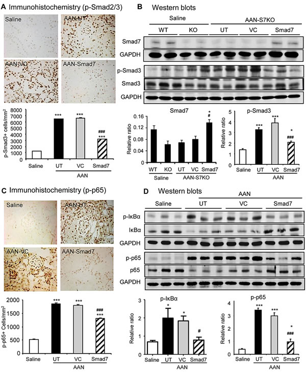 Restored renal Smad7 blocks TGF-&#x3b2;/Smad and NF-&#x3ba;B signaling in the kidney of Smad7 KO mice with chronic AAN at day 42 after induction of AAN.