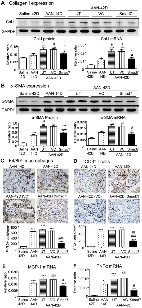 Local Smad7 therapy inhibits progressive renal fibrosis and inflammation in Smad7 WT mice with established chronic AAN at day 42.