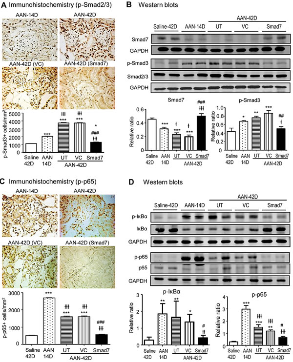 Smad7 treatment locally in the kidney with the established chronic AAN blocks activation of TGF-&#x3b2;/Smad and NF-&#x3ba;B signaling.