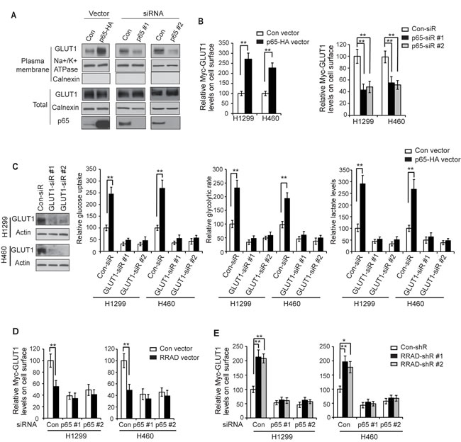 RRAD inhibits GLUT1 translocation to the plasma membrane through down-regulating NF-&#x3ba;B signaling.