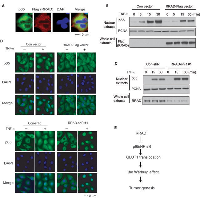 RRAD inhibits the nuclear translocation of p65.