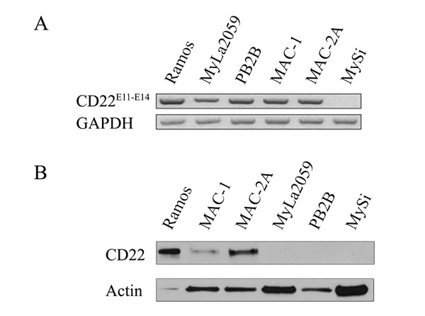 Expression of CD22 in CTCL cell lines.