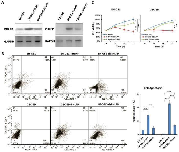 PHLPP induces apoptosis and inhibits proliferation in GBC cells.