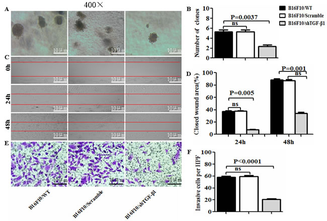 Observation of cell biological property in B16F10/shTGF-&#x3b2;1 cells.