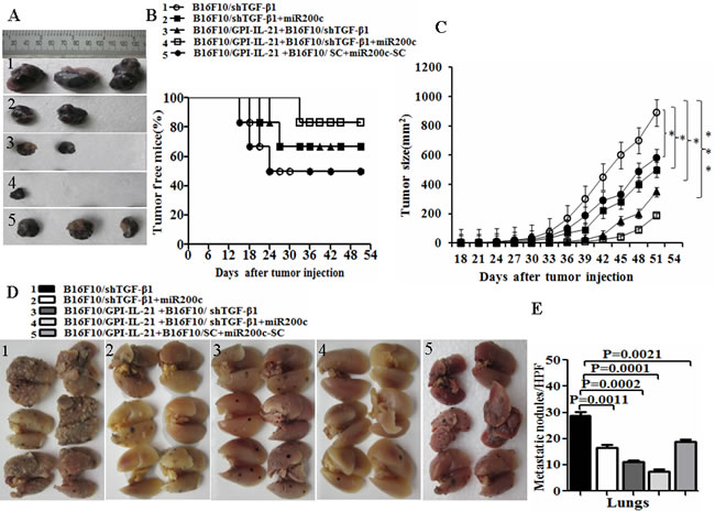 Tumor growth and metastasis in vaccinated mice challenged with B16F10/shTGF-&#x3b2;1 cells plus minus miR200c agomir.