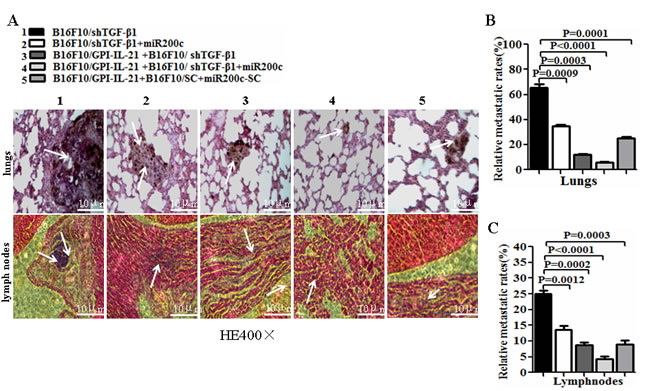 Histological analysis of lungs and lymph nodes of melanoma bearing mice.