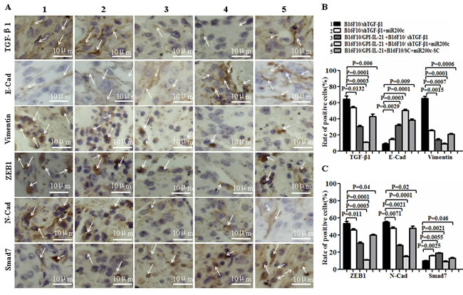 EMT-associated molecule expression analyzed by immu&shy;nohistochemistry and Western blot in vaccinated mice challenged with B16F10/shTGF-&#x3b2;1 cells plus minus miR200c agomir.