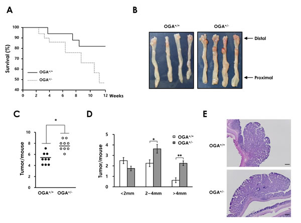 Elevated O-GlcNAcylation contributes to colonic tumorigenesis in a mouse model of CAC.