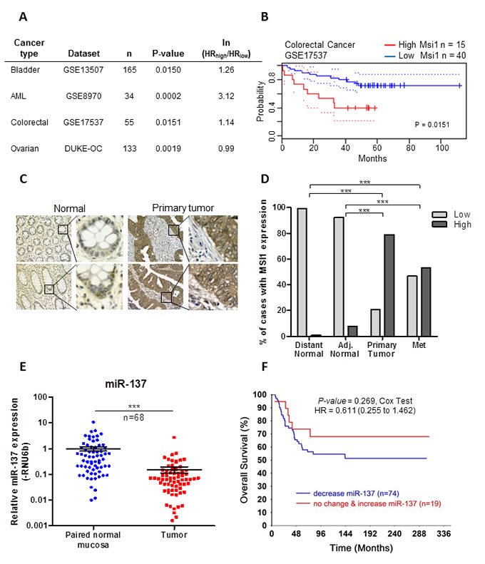 Musashi-1 is over expressed and miR-137 is decreased in rectal cancer tissue samples.