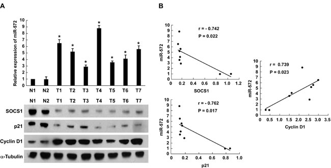 Expression of miR-572, SOCS1, p21 and Cyclin D1 in human ovarian cancer tissues.