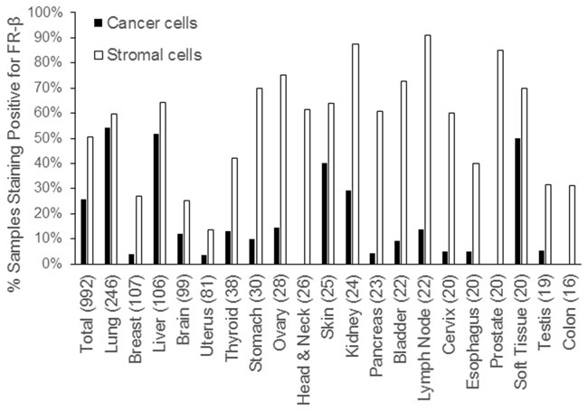 Prevalence of FR-&#x3b2; expressing cancer and stromal cells in various human tumor sections.