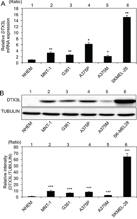 Increased expression levels of DTX3L in melanoma cells in humans.