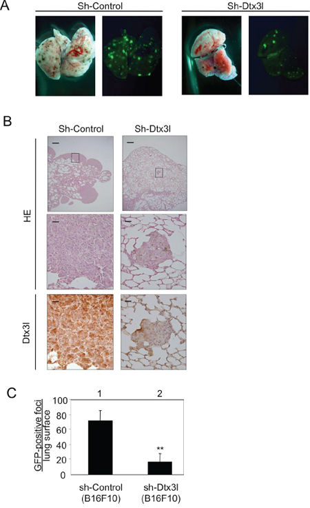 Decreased lung metastasis in Dtx3l-depleted melanoma cells in vivo.
