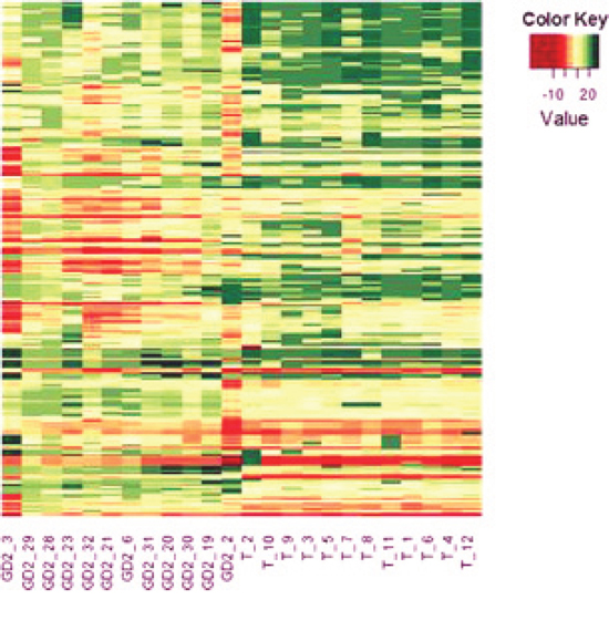Heat-map of miRNAs differentially expressed by BM-infiltrating cells and primary tumors.