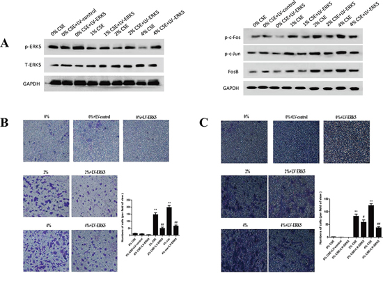 Overexpression of ERK5 reverses TS-triggered EMT morphological change and migratory and invasive capacities of normal human bronchial epithelial (NHBE) cells.