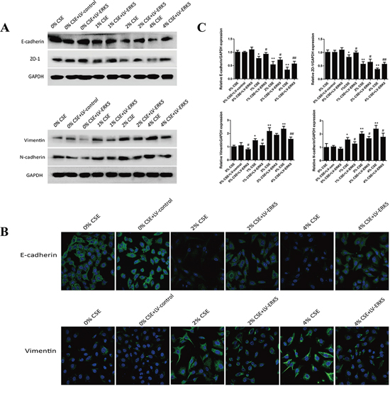 ERK5 overexpression attenuates TS-induced alterations in EMT markers&#x2019; expression in normal human bronchial epithelial (NHBE) cells.
