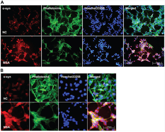 Increased expression and mislocalization of &#x03B1;-syn in SH-SY5Y following exposure to MSA-CSF.