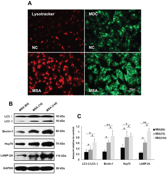 Induction of autophagy in SH-SY5Y cells following exposure to MSA-CSF.