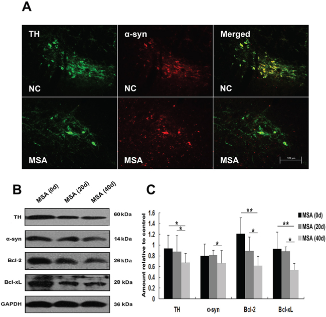 MSA-CSF treatment caused degeneration of TH-positive neurons in striatum nigra.