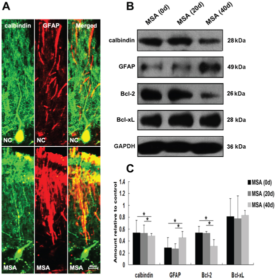 MSA-CSF treatment caused degeneration of Purkinje cells in cerebellum cortex.
